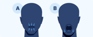 Diagram illustrating the jaw strengthening snoring exercise.