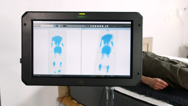Sleep Foundation tester undergoing back-sleeping pressure mapping on the Brooklyn Bedding Plank Hybrid mattress