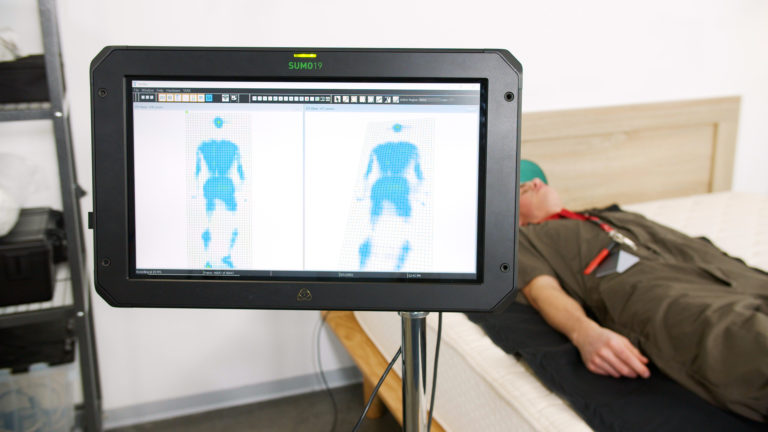Close-up of back-sleeping pressure mapping results for the Latex for Less Mattress