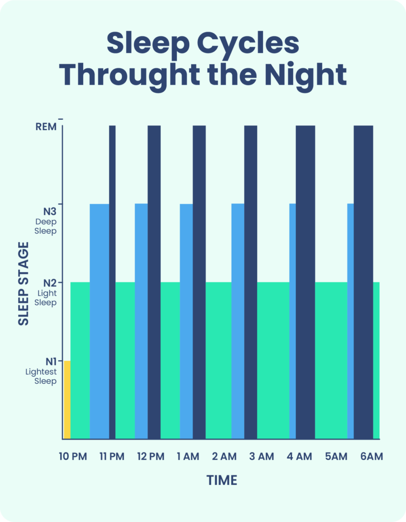 A normal sleep cycle graph showing the time spent in N1, N2, N3, and REM stages of sleep.
