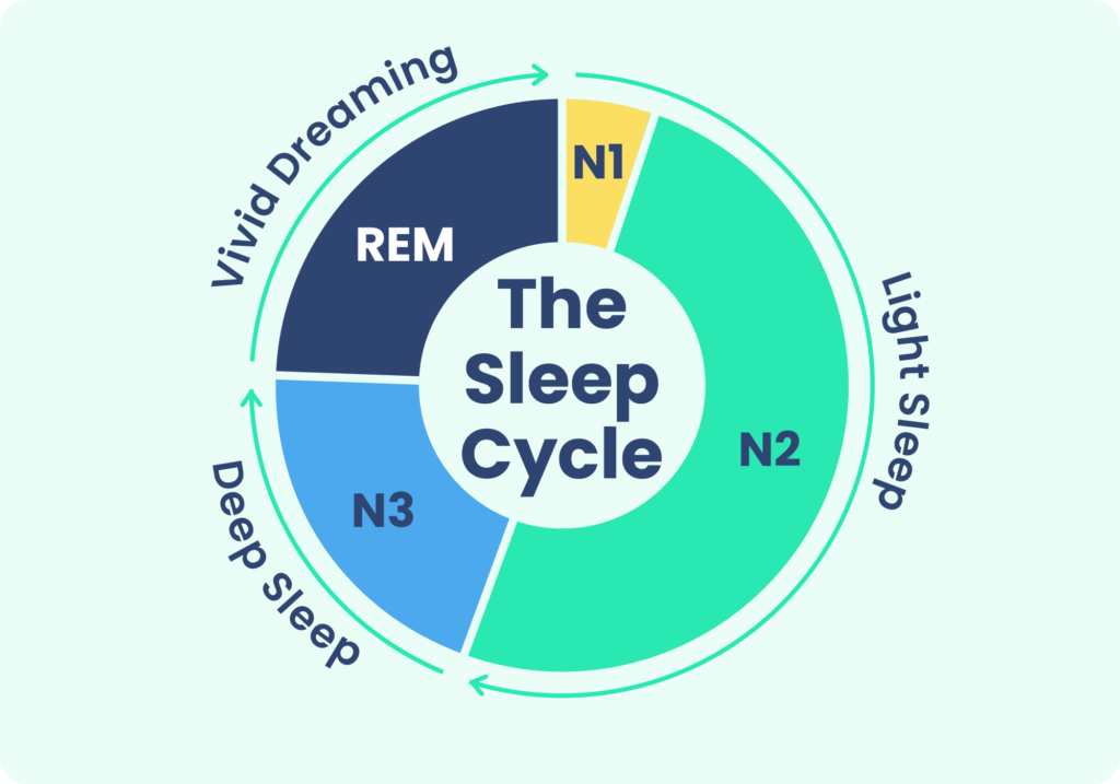 A normal sleep cycle graph showing the time spent in N1, N2, N3, and REM stages of sleep.