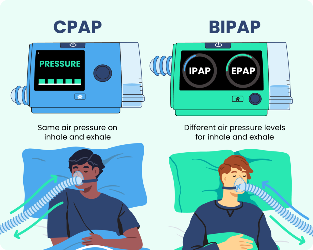 An example of an BiPAP machine next to a CPAP machine. 
