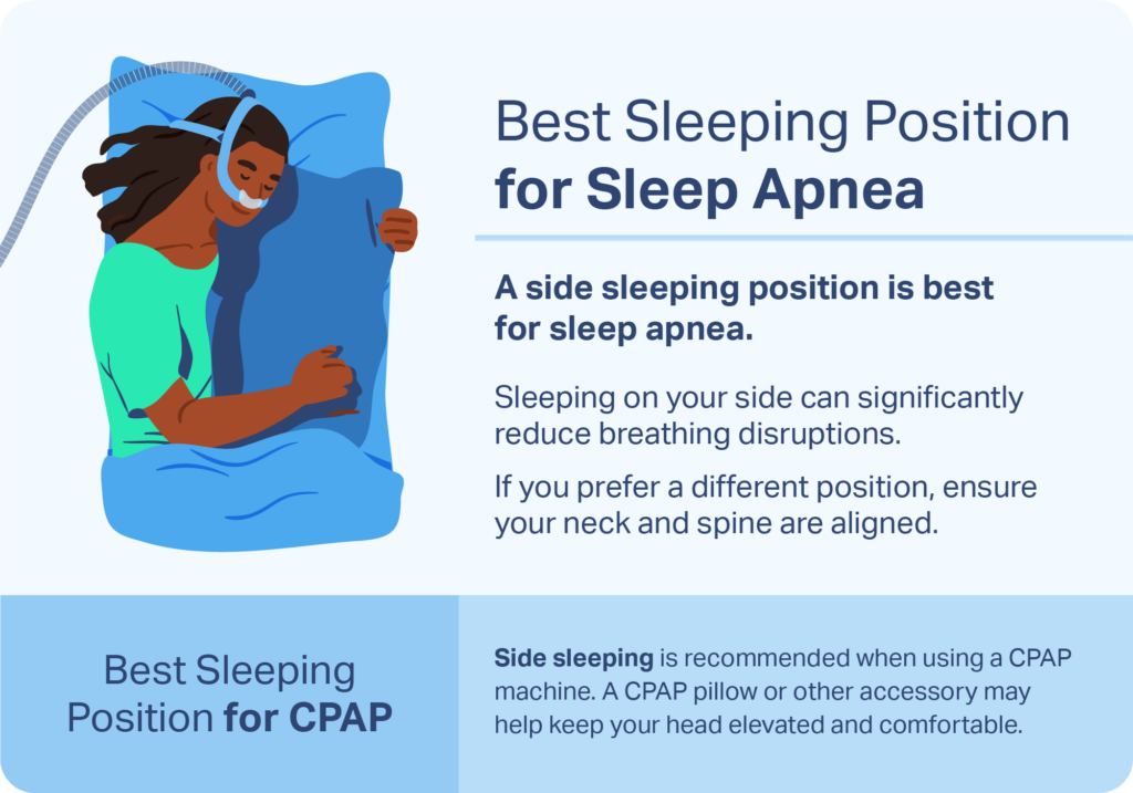 Illustration of a person using a CPAP device sleeping on their side. 